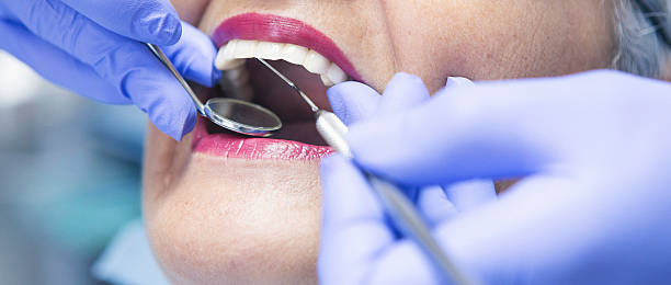 Best Emergency Dental Care for Broken or Chipped Teeth in Edwardsville, PA